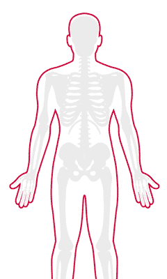 Neuropathic Pain Treatment